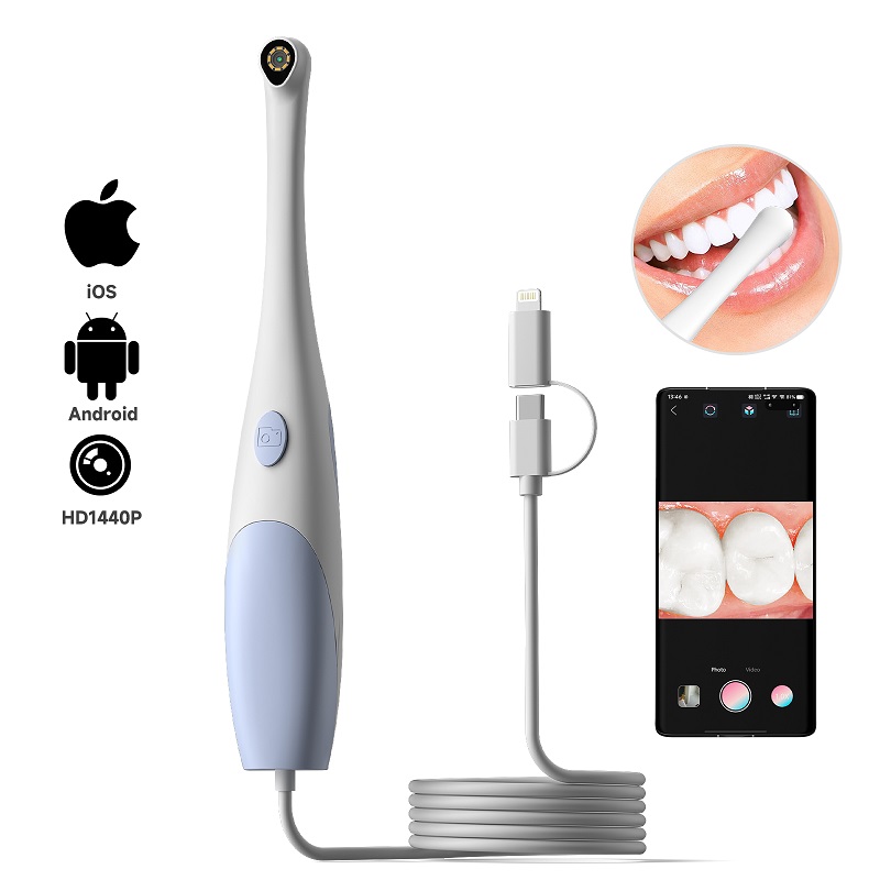 Oral Endoscope Camera 1440P Ph - đánh giá và giá Lighting Visual
