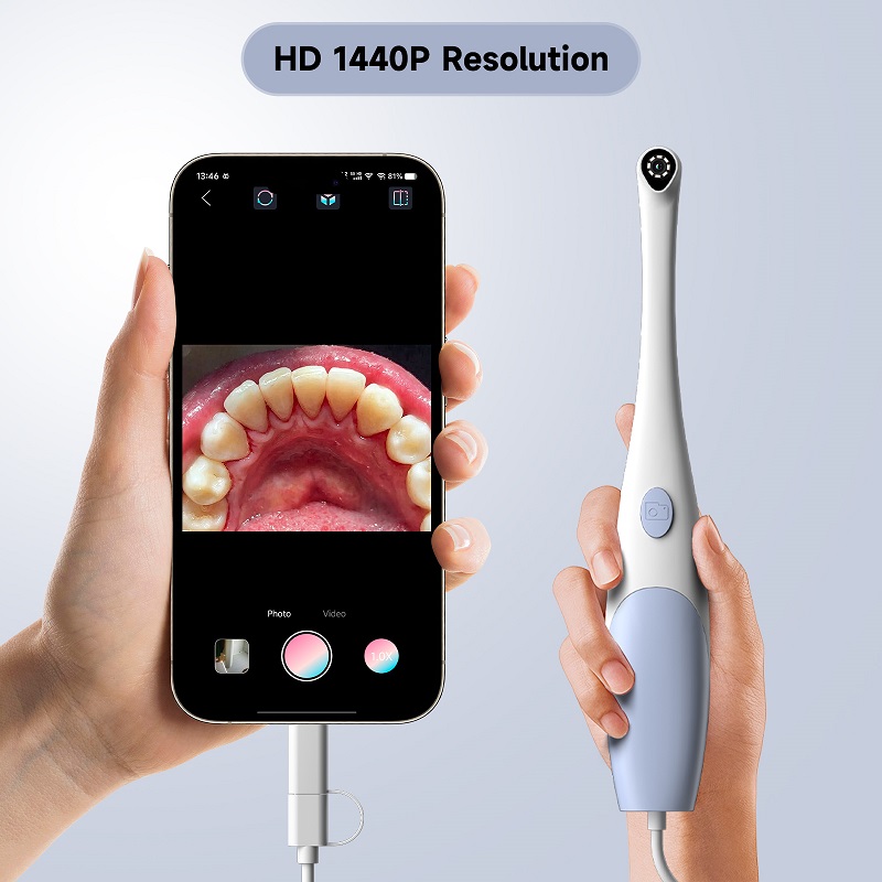 Oral Endoscope Camera 1440P Ph - đánh giá và giá Lighting Visual