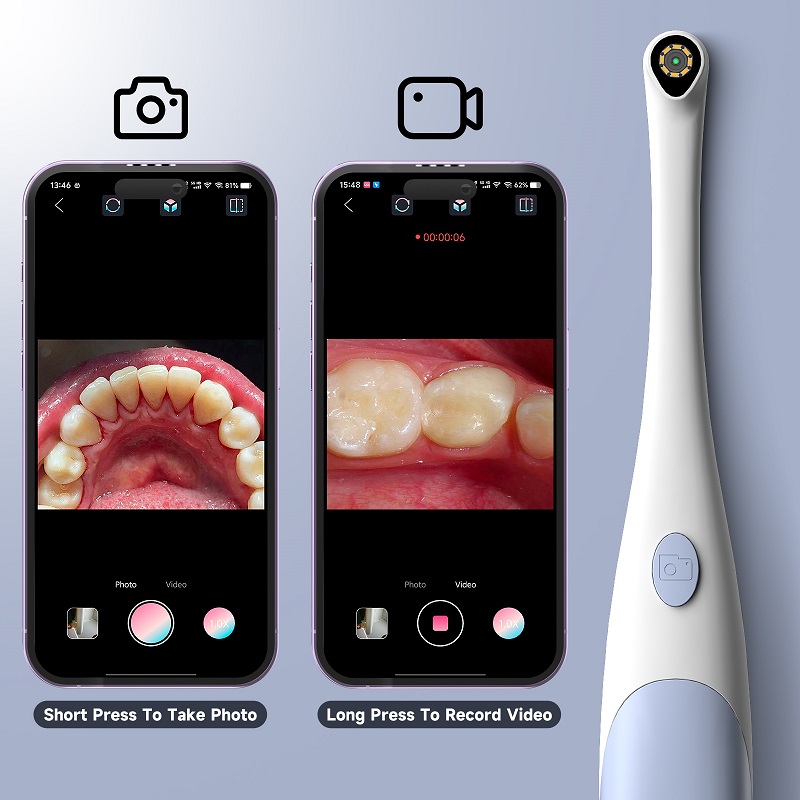 Oral Endoscope Camera 1440P Ph - đánh giá và giá Lighting Visual